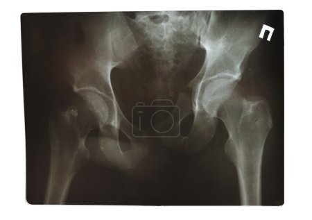 X-Ray shot