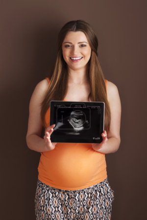 Pregnant woman showing ultrasound scan