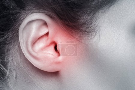 Close up view of female ear with source of pain