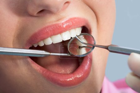 Patients open mouth before oral inspection